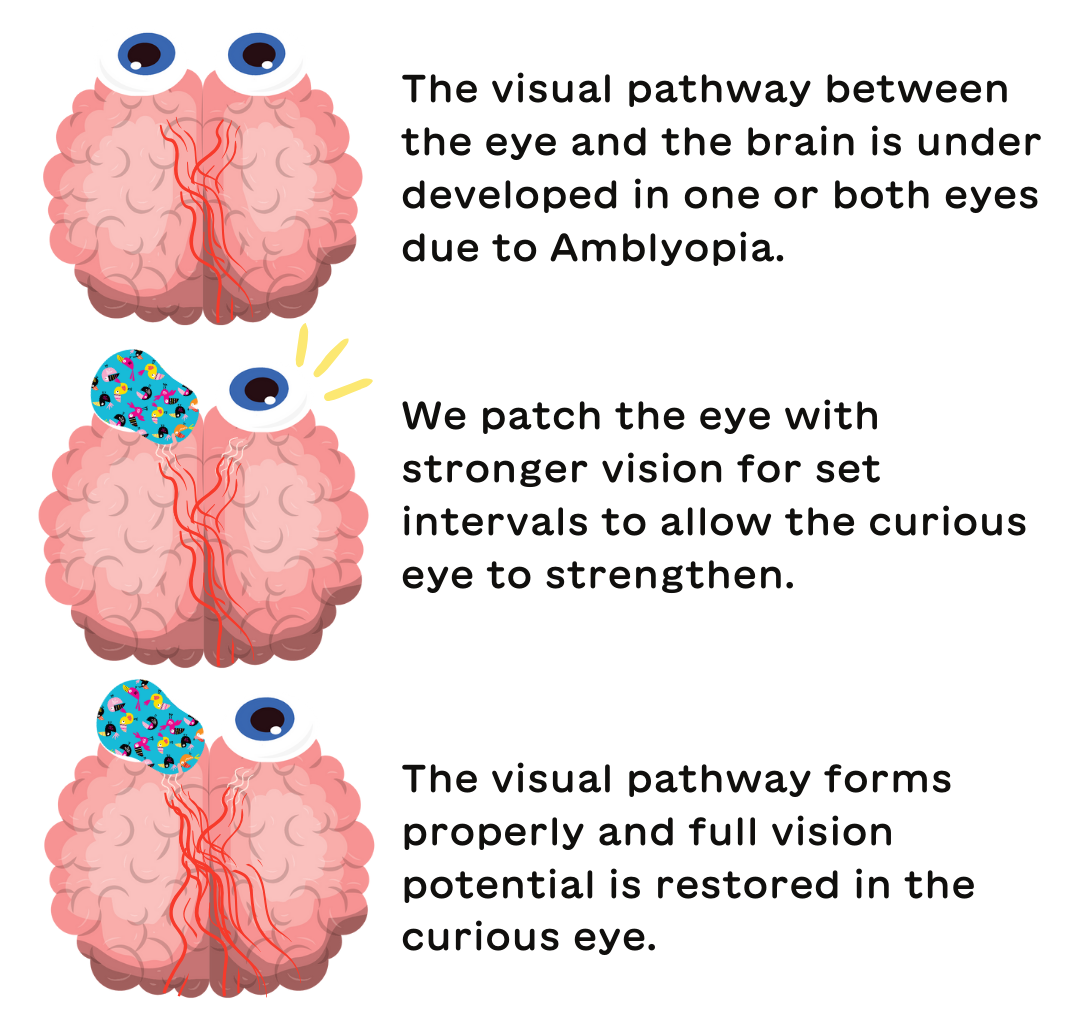 Disney Princess & Marvel Eye Patches for Kids - Hypoallergenic & Fun ...